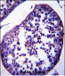 SPATA18 Antibody (N-term)